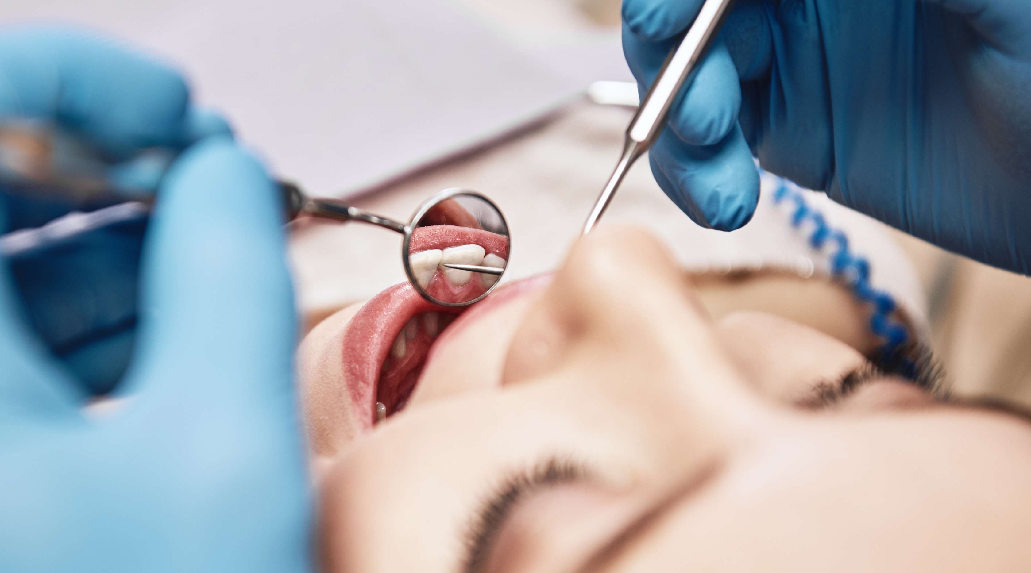 Junge lächelnde Frau auf Behandlungsstuhl, während Zahnarzt mit blauen Handschuhen Zahnbesteck vor ihren Mund hält.